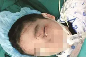 江都一小学生课间打闹导致视力受损，责任由谁来承担？图片