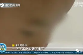 揪心！20多厘米筷子贯穿孩子喉咙！家长千万当心……图片