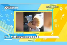 澳大利亚女孩患难梳头发综合征，爱因斯坦也受其扰，这是什么病？视频封面