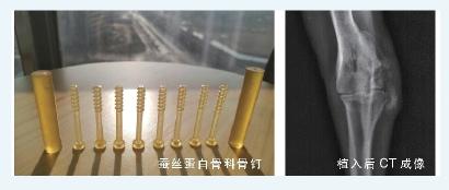 点“丝”成金！蚕丝蛋白变身医疗器械、硬盘存储，锁住生命与记忆