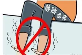 静脉曲张患者如何锻炼图片