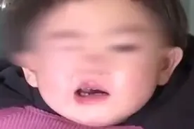 心疼！2岁女童吹风受寒后面瘫