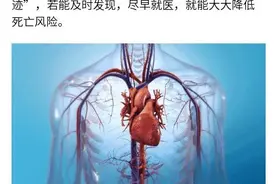 心梗发作有条“时间轨迹”：从1个月前到1小时前各有表现图片