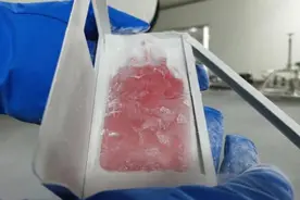 珍贵脐带血“沉睡”14年后复苏挽救生命，产科教授呼吁有条件的家庭储存脐带血图片