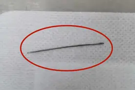 滨州：睡了一觉，针从前胸扎进肺里，当时居然没当回事儿……图片