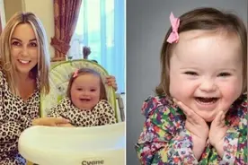 唐氏综合征女童变身时装模特 镜头前展现自信笑容图片