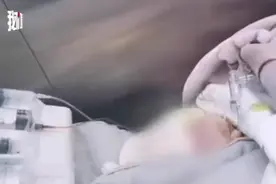 4个月大的重症患儿乘高铁从包头转运到京救治，顺利抵达医院图片