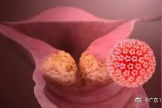 切除子宫会加速衰老的说法有科学依据吗？图片