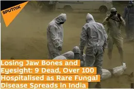 印度新冠康复患者体内现罕见真菌已致9死 医生：该病死亡率为50%图片