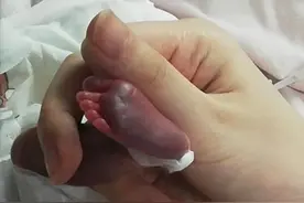 26周出生体重仅1.5斤“手掌婴儿”周岁“回家”庆生暖人心图片