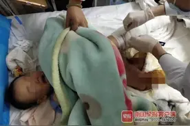 洗屁股前幼师没测水温，防城港男童被烫成九级伤残图片