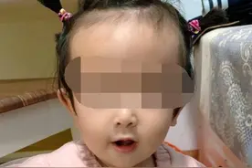 急切求医！南宁13个月大女婴家中溺水被诊断为脑死亡图片