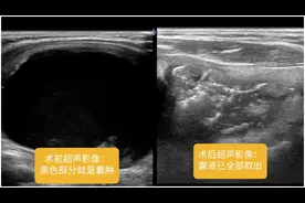 “年轻时是合唱团领唱，如今却被人说唱歌难听！”她备受打击：究竟是怎么了？图片