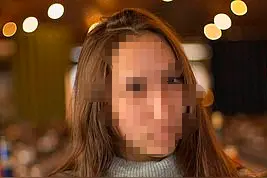 触目惊心！外媒：俄20岁美甲师遭10只流浪狗袭击，“面目全非”图片