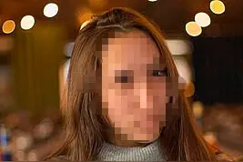 触目惊心！俄20岁美甲师遭10只流浪狗袭击“面目全非”图片