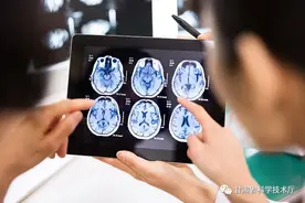 科技名词 | 什么是医学影像技术学？图片