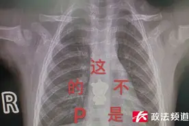 一岁女童体内“藏”了个小猪佩奇？！真相让人后怕图片