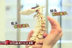 平躺也会导致颈椎病！床上这一物，朝夕相伴，最伤颈椎，千万小心图片