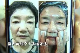 59岁大姐花25万整形变年轻“慈眉善目”变得“很凶很凶”图片