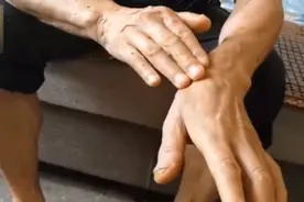 洗澡后容易出现皮肤瘙痒？快试试这个方法视频封面