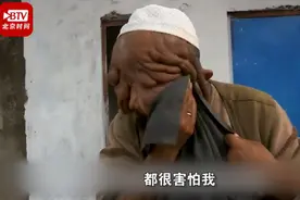 “大家都叫我无脸男”！印度一男子满脸肉瘤，曾险被当野兽枪杀图片