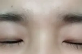 萧山一姑娘花一万多割双眼皮，晒前后对比照，引网友热议图片