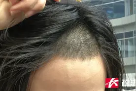 “在家镜子都不敢照！”长沙一女子去理发店做头发，店员把她发际线烧了图片