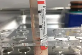 长沙22岁女老师每天一杯奶茶，突然晕倒小便失禁，抽血都是乳白色图片