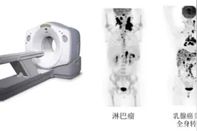 揭开核医学的神秘面纱图片