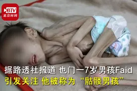 也门一7岁男孩体重仅7公斤，不敢多看一眼！网友哭了图片