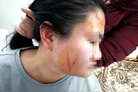 烟台：女子公交车上莫名发飙 女医生仗义出手被抓伤图片