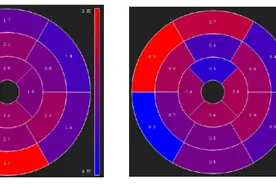 山东大学齐鲁医院完成该院首例心脏功能磁共振检查图片