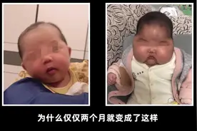 5月女婴使用面霜后变“大头娃娃”！发育迟缓，脸硬如石……最新通报：停产图片