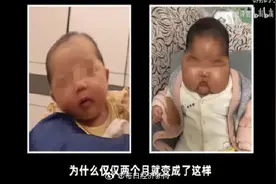 5月女婴使用抑菌霜后变大头娃娃？官方回应、涉事企业已停产图片