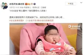 5个月女婴被曝使用面霜后变“大头娃娃”，脸硬得像石头！卫健委回应图片