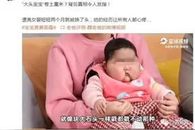 5个月女婴被曝使用面霜后变“大头娃娃”，脸硬得像石头！卫健委回应图片