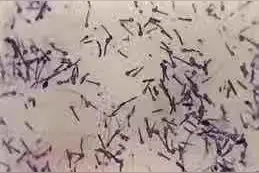 破伤风的那些事儿图片