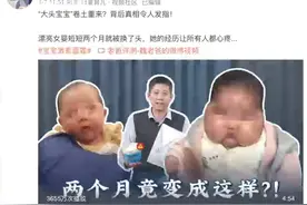 惊！又有数十例“大头宝宝”现身 家长回应炒作质疑图片