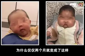 激素面霜涂出“大头娃娃”，蓝白药膏还能放心用吗？图片
