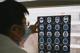 如何正确拍摄医学片子发给医生？视频封面