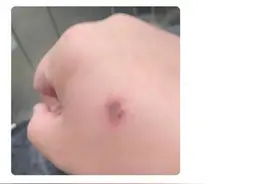 钢丝棉走红网络：“最灿烂的烟火”远比你想的危险图片