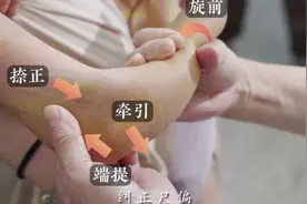 “坏奶奶”竟是接骨天使！从5个月婴儿到97岁老人，都因她免于手术图片