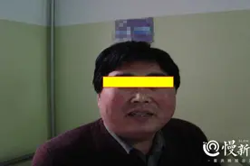 慢生活·健康 | 满月脸是福相？错！这些病都可以从脸看出端倪图片