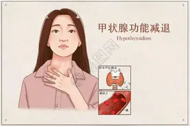 甲减患者注意了，这些饮食禁忌你要知道图片