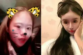 “接受变美的代价，别学我！”00后学生整容上百次，前后对比照曝光图片