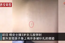 密密麻麻！西安一幼儿园3岁女童身上有29处针眼，校方至今未回复图片