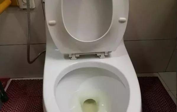 一勺白醋解决厕所臭味问题，赶紧学起来吧