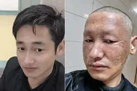 这组对比照，太让人心疼了图片
