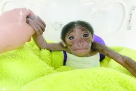 国内首例剖腹产合趾猿宝宝“满月”图片