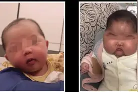 女婴使用抑菌霜变“大头娃娃”引社会关注，专家建议宝宝护肤品别选“消字号”图片